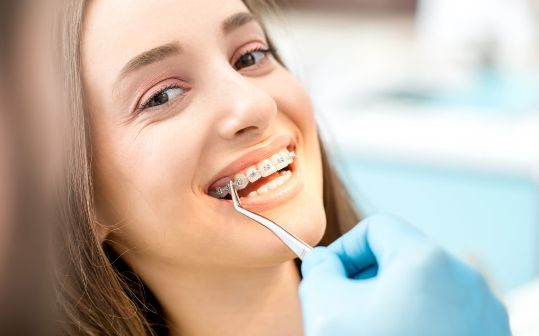 How to Decrease the Cost of Braces