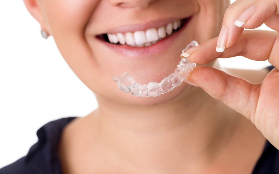 The Pros and Cons of Invisalign, Clear Braces, and Cosmetic Orthodontic  Treatment - Ask Dr Reynolds